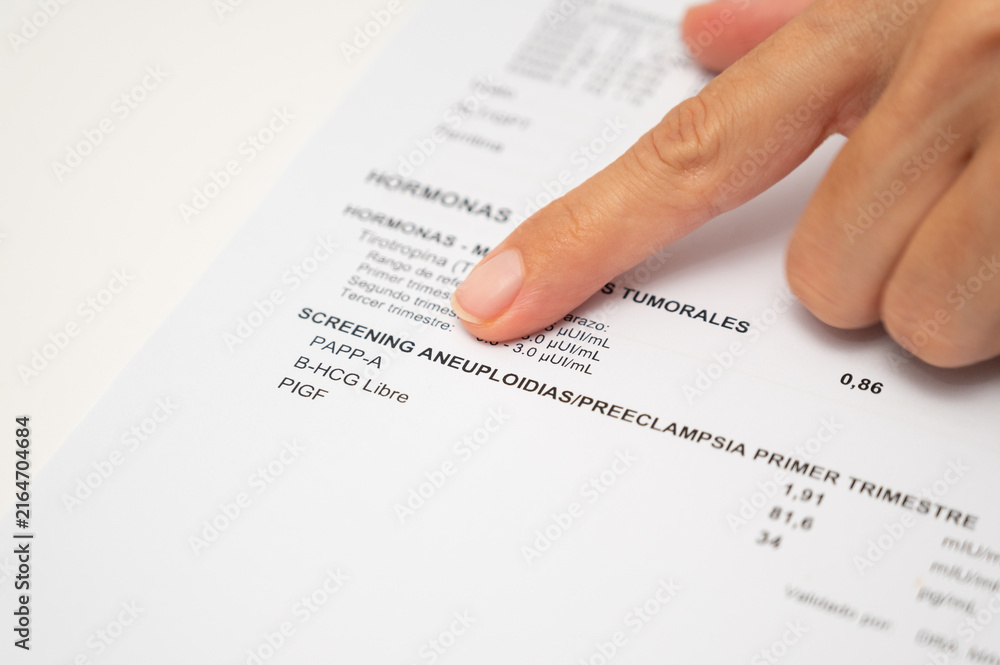 Obraz premium Close up of person marking tsh papp-a and hcg hormone test results on paper