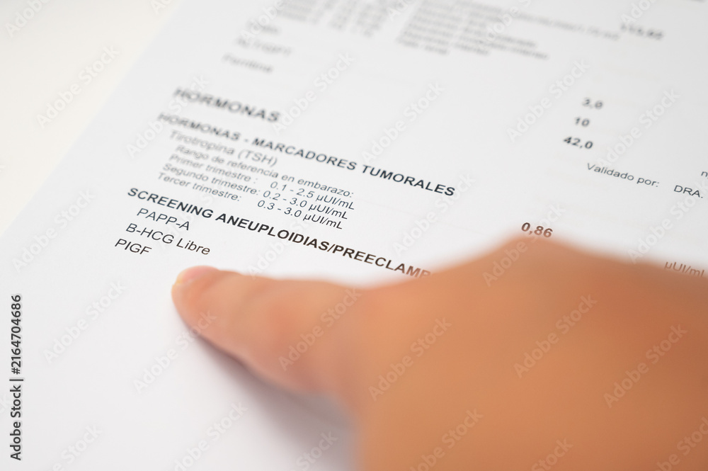 Fototapeta premium Hand pointing to aneuploidy preeclampsia screening blood test results