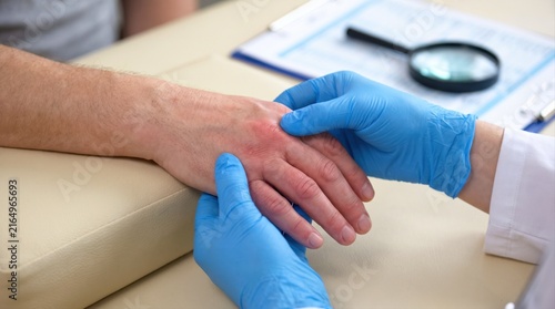 A healthcare provider wearing blue gloves conducts a physical examination on a patient's hand.
