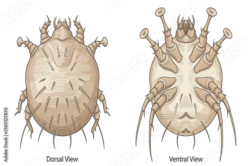 Educational medical illustration showing Sarcoptes scabiei, emphasizing its microscopic anatomy, parasitic characteristics, and association with human scabies infection.