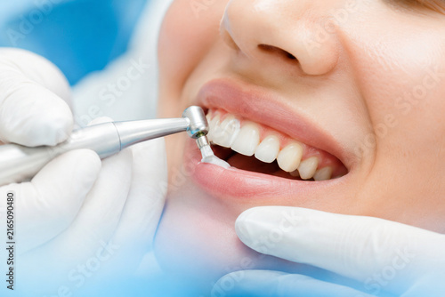 Close-Up Professional Dental Polishing