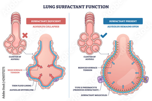 Foto Lung surfactant function illustrated, comparison of open and collapsed alveolus, surfactant molecules and type II pneumocyte reduce surface tension to keep alveoli open, transparent background