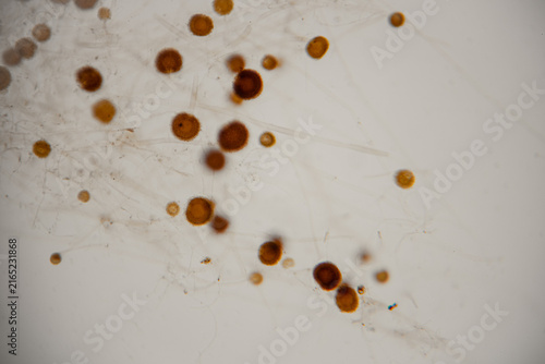 Foto Microscopic view of brown circular spores and filaments on a white background, s