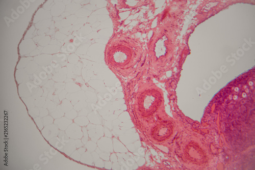Fotografía Microscopic view of human tissue section showing adipose cells and blood vessels
