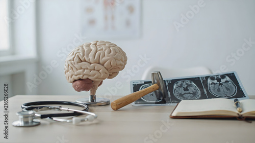 Anatomical brain model with a reflex hammer stethoscope and medical scan images