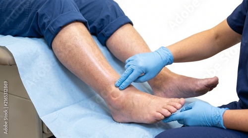 Adult Patient Undergoing Clinical Examination for Bilateral Peripheral Edema