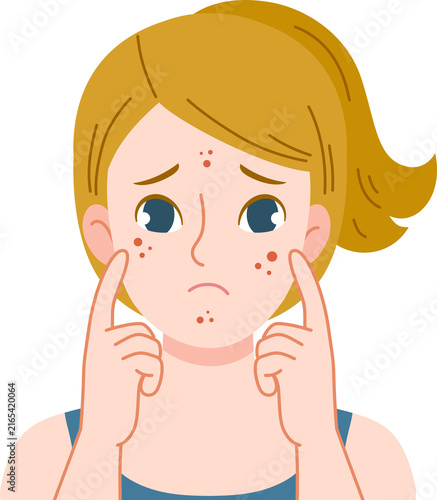 woman worried with acne problem