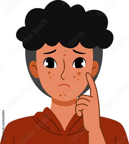man worried with skin problem
