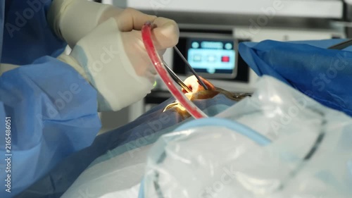 Surgeon inserts arthroscope into patient nose during rhinoplasty operation in hospital room closeup. Doctor conducts surgery with instrumentation