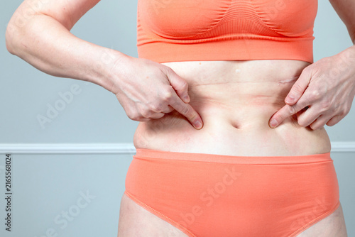 Cuadro en lienzo Woman pointing at belly showing bloating digestion problems, stomach pain or abd