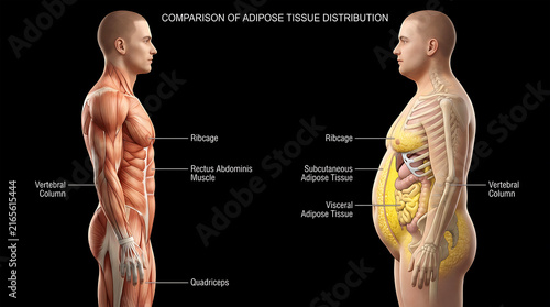 Male body composition comparison, subcutaneous and visceral fat distribution