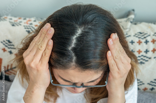 Foto High angle view of Asian showing her forehead with part of her thin hair, she had hair loss problem