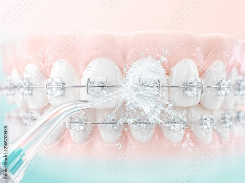 Water Flosser Cleaning Orthodontic Braces
