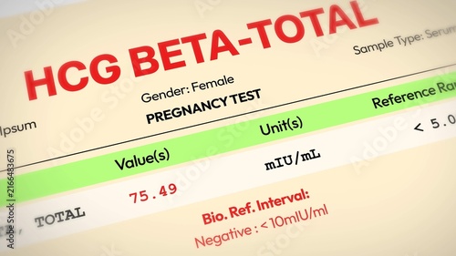 Pregnancy test results sheet with hcg beta-total levels and reference range, 4k animation.