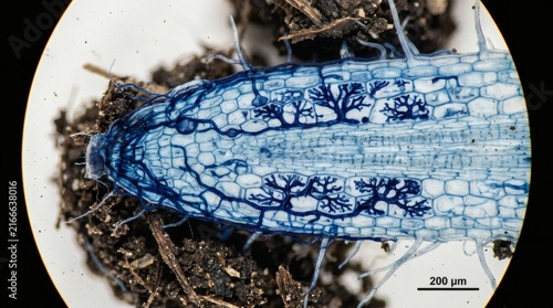 Microscopic view of plant root cells stained blue with fungal hyphae