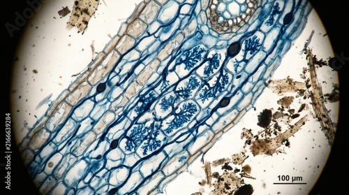 Microscopic view of plant root cells showing fungal hyphae and cellular structures