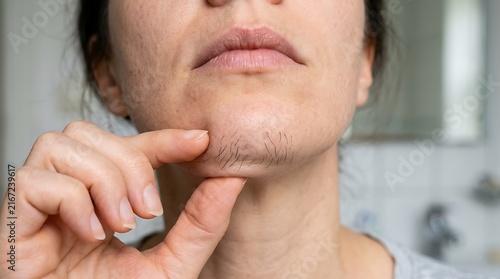 Woman is touching her chin, highlighting the dark facial hair growth on her lower face, indicating a common issue of unwanted hair in women.