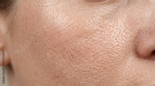 Extreme macro close up of rough skin texture, enlarged pores, deep wrinkles, and severe sun damage on a human cheek