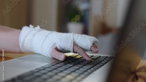 Child with casted hand presses fingers on laptop keyboard, close up. Remote school home learning during treatment and recovery after injury.