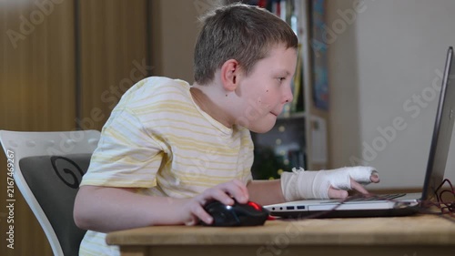 Boy with injured hand emotionally complains and speaks to screen during use of laptop. Child with casted fingers and wrist uses compact computer for gaming and distraction from injury.
