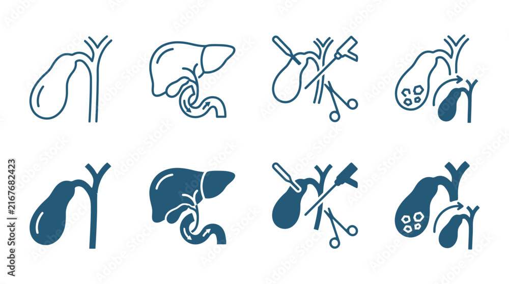 Fototapeta premium Set of human gallbladder anatomy and surgery medical icons illustrating internal organs and surgical procedures