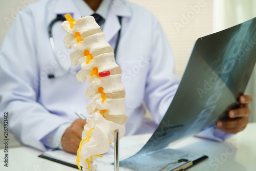 Foto Doctor examining spine bone radiography xray film.