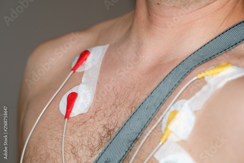 Male patient has Holter monitor electrodes affixed to chest with adhesive pads, displaying skin texture and medical monitoring equipment