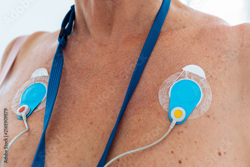Bild auf Leinwand Ambulatory Blood Pressure Monitoring