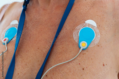 Фотография Ambulatory Blood Pressure Monitoring
