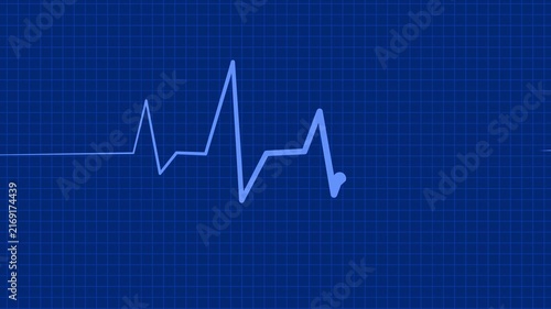 Heartbeat line pulse waveform medical concept health monitor background simple minimal design animation