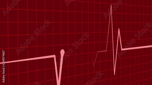 Ecg heartbeat line sharp pulse spike showing a medical monitor trace and a simple health care animation