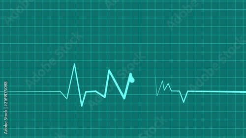 Zigzag line sharp rise and fall suggesting data heart rhythm wave pulse animation