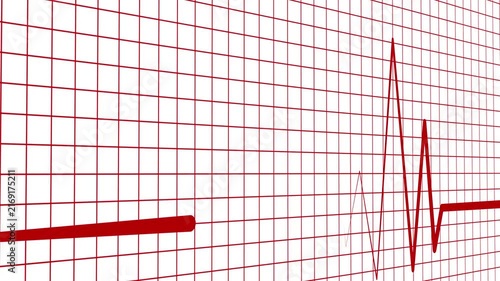 Heart rhythm line heartbeat spikes and flat line showing medical pulse and emergency concept animation