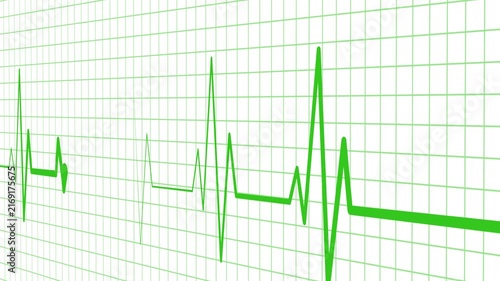 Electrocardiogram line heartbeat rhythm and medical monitor trace animation