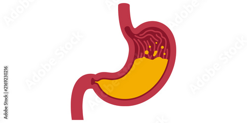 Cuadro en lienzo Illustration of human stomach anatomy with digestive juices shown in yellow for medical education purposes