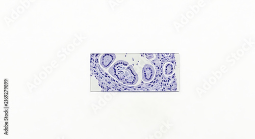 Microscopic view of stained biological tissue sample on a glass slide against white background with tissue specimen rectangular