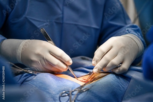 Surgeon performing delicate operation with forceps and scalpel in sterile operating room.
