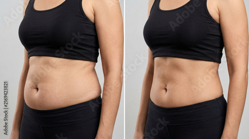 Before and After Weight Loss Transformation - Woman's Body Comparison