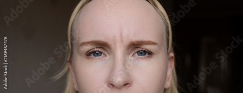 A adult woman touching forehead wrinkle between eyebrows and looking in mirror. She is concerned about aging lines, frown lines, facial skin care, and botox injections.