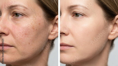 Before and After Skincare: Woman's Face with Aging Signs and Smooth Skin