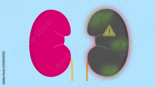 Healthy kidney next to sick kidney with toxic damage and crack