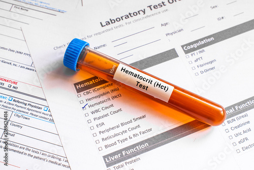 Fotografie blood sample in lab tube for Hematocrit (Hct) test