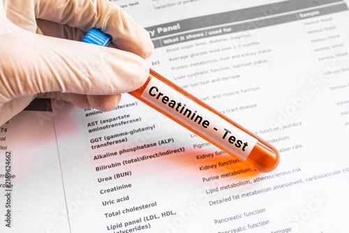 blood sample in lab tube for Creatinine test