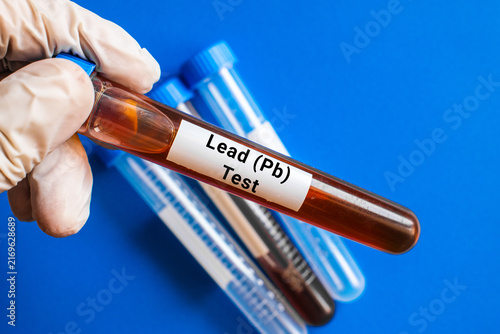 Fototapeta kuchenna blood sample in lab test tube for Lead Pb