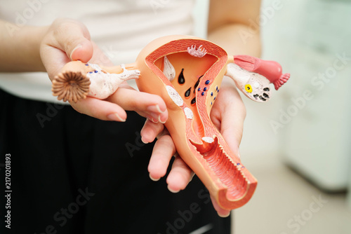 Obraz na płótnie Uterus, Asian, woman holding human anatomy model.
