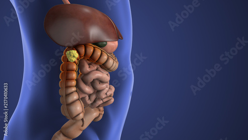 Obraz na płótnie Colon Polyp Developing Inside the Large Intestine