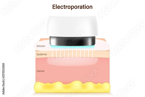 Electroporation. Infusing vitamins into the skin layers using an electroporation device. Vector for advertising about beauty and medical treatment.