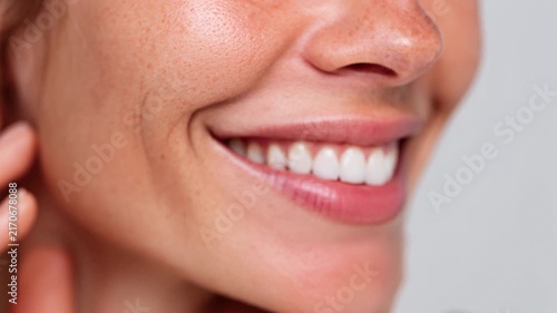 Close-up of a smiling woman with freckles touching her face, showcasing perfect white teeth and healthy skin.