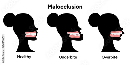 Common dental and orthodontic problems, including underbite, overbite, open bite, crowding, crossbite, spacing, protrusion, and abnormal tooth eruption