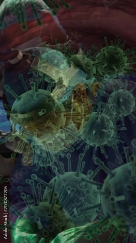 Multiple covid-19 cells floating against team of surgeons performing surgery at hospital